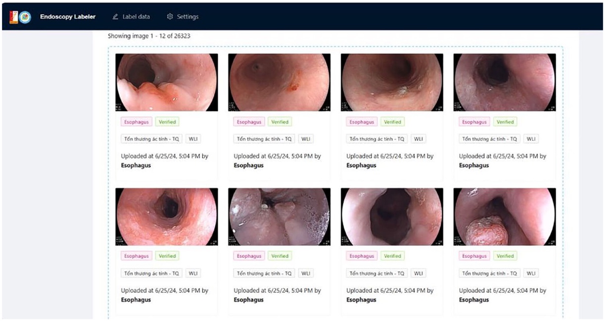 Endoscopy Labeler interface displays eight gastroscope images of the esophagus in a two-row grid. The views show the esophageal lumen and surrounding mucosal surfaces, with varied folds and localized raised or discolored areas. Each card is labeled Esophagus, Verified, WLI, and a Vietnamese category tag, with upload details below.
