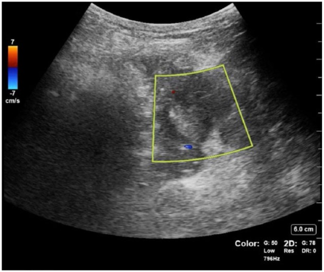Color Doppler ultrasound shows a kidney in longitudinal view within surrounding abdominal tissue. A boxed sampling region covers most of the organ, with small red and blue flow signals inside. The Doppler scale ranges from negative 7 to 7 centimeters per second, and the image depth is 6 centimeters.